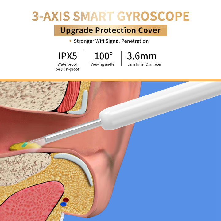 Ear Cleaner Otoscope with Camera